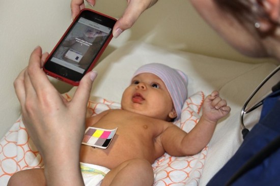 تطبيق للهواتف الذكية يتيح للآباء والأطباء الكشف عن الصفراء بين حديثي الولادة